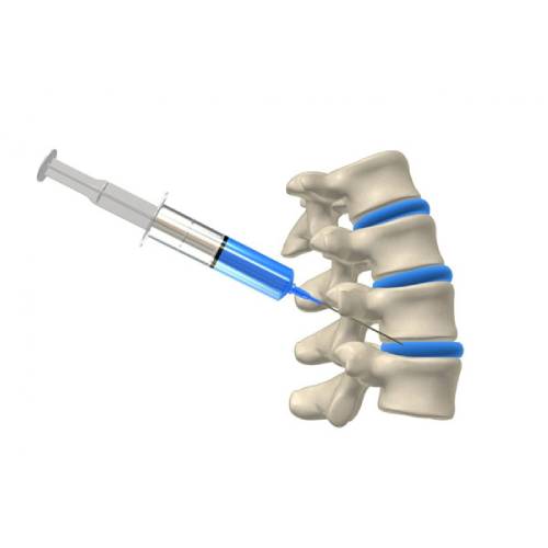 The image shows spinal injections for relief from neck and back pain.