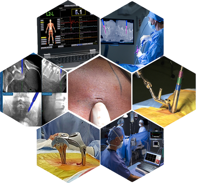 A collage illustrating the latest advancements in spine surgery.